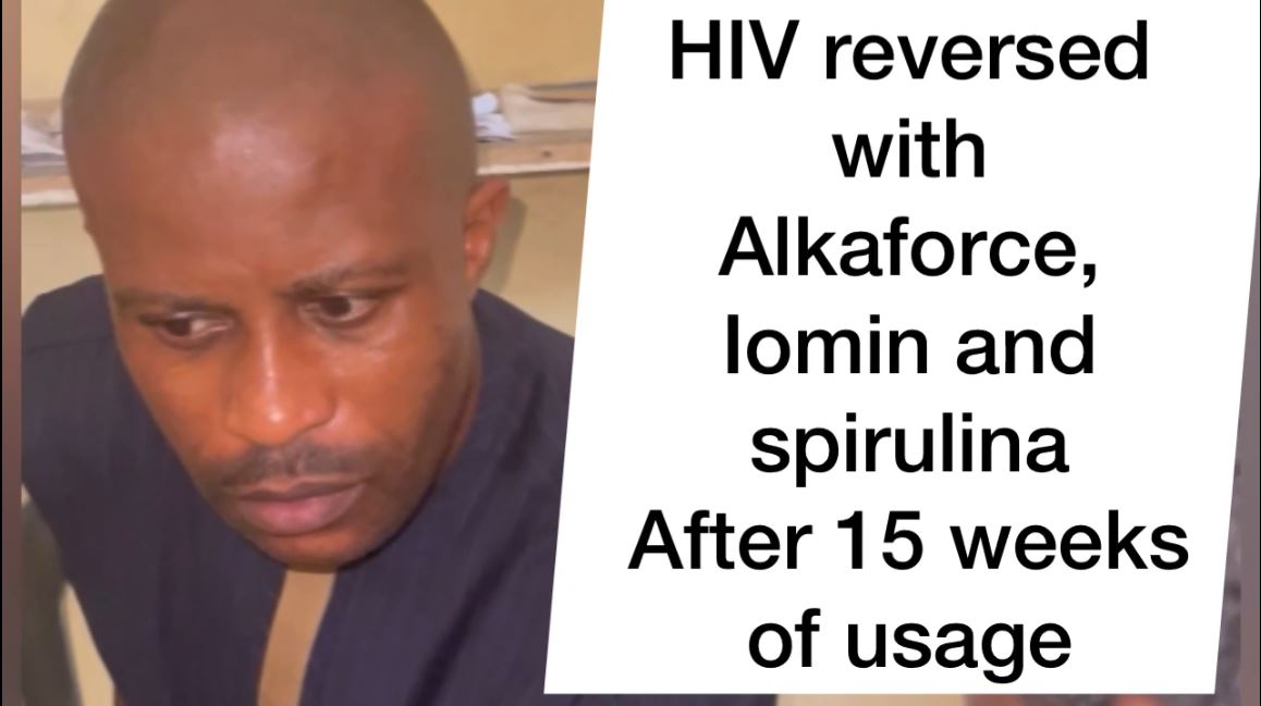 HIV WIPED OUT COMPLETELY
